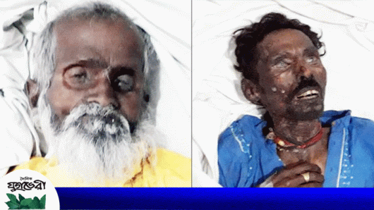 ওসমানী হাসপাতালে ২ অজ্ঞাত মরদেহ