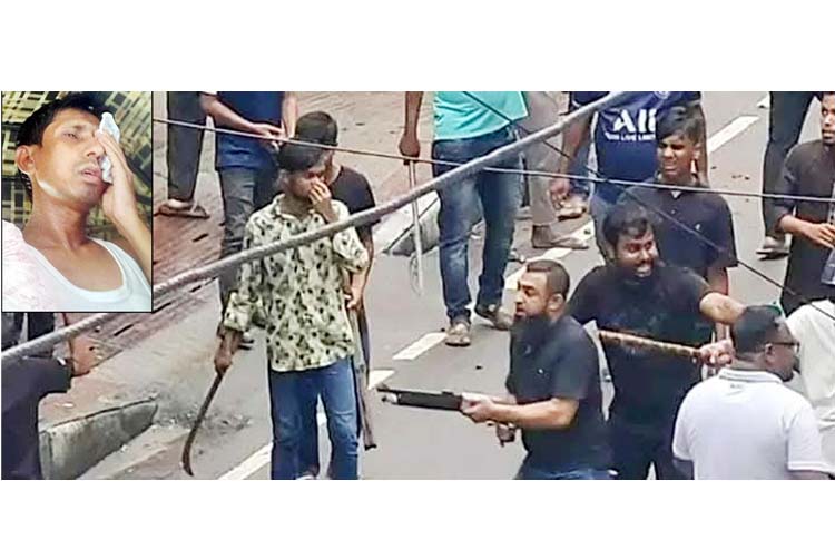 সিলেটে বিএনপির মিছিলে গুলি, মামলা করলেন চোখ হারানো ছাত্রদল নেতা টিপু